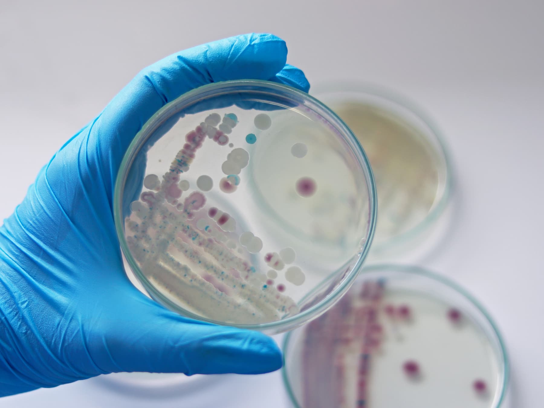 Augmentation des infections a Vibrio vulnificus